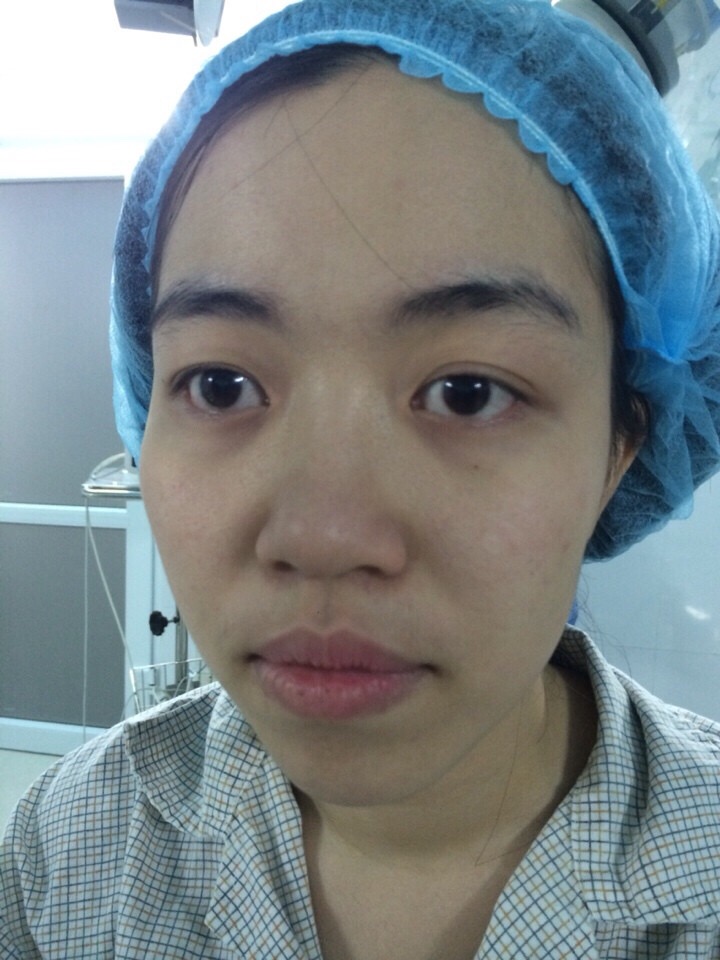 CEO Đào Minh Châu trước khi quyết định phẫu thuật thẩm mỹ 