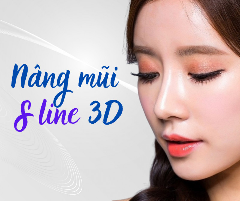 Nâng mũi S line 3D là gì? Tìm hiểu chi tiết phương pháp này  