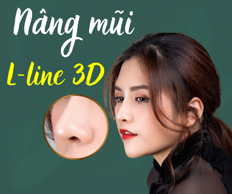 Nâng mũi L Line 3D phương pháp sở hữu dáng mũi đẹp hoàn hảo