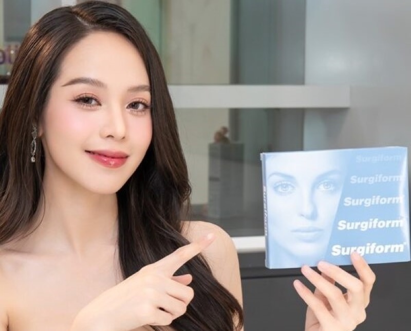 Phương pháp nâng mũi sụn Surgiform    