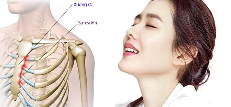 Nâng mũi bằng sụn sườn có ưu điểm gì? Tổng quan về phương pháp mới này! (Hình minh họa)