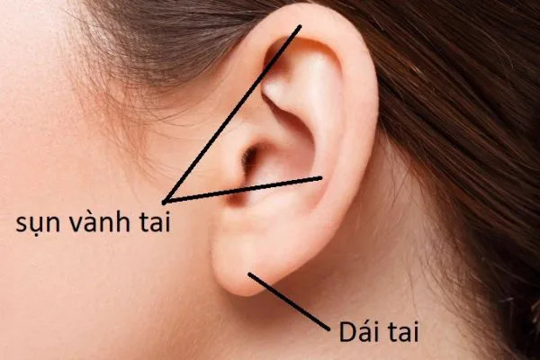 Hình ảnh vị trí sụn vành tai 