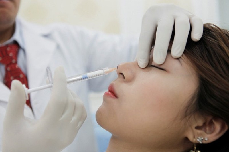 Tiêm filler mũi ổn định sau khoảng 1 tuần khi hoàn thành (hình ảnh minh họa)