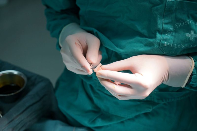 Việc nâng mũi quá sớm có ảnh hưởng gì đến sự phát triển của khuôn mặt sau này