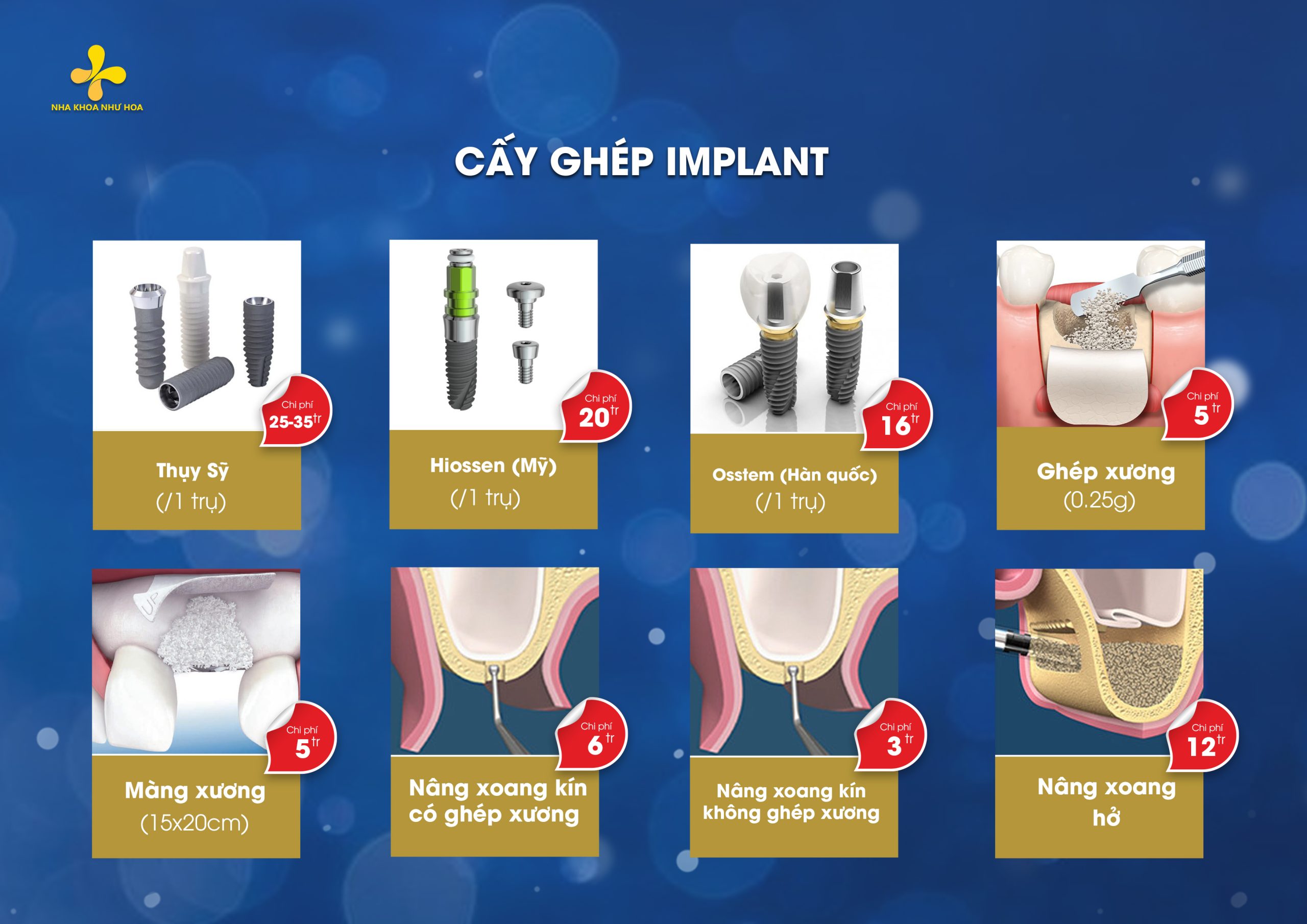 cay ghep rang implant scaled