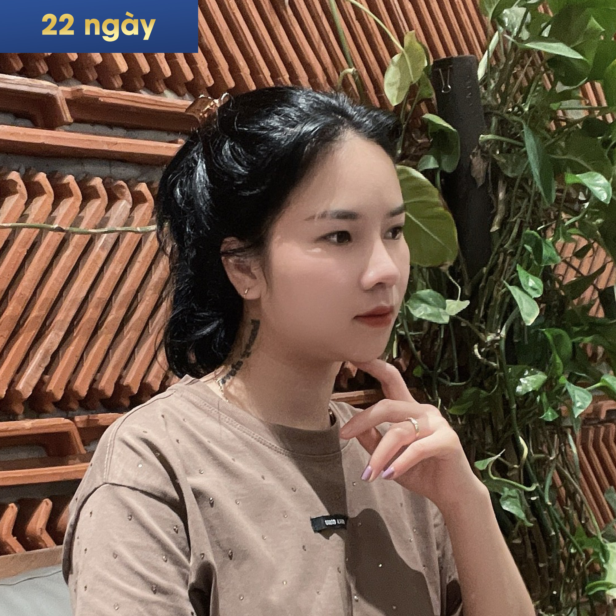 Sau 22 ngày phẫu thuật