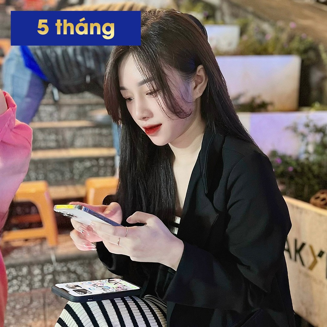 Thành quả với chiếc mũi sau 5 tháng vô cùng tự nhiên, thanh thoát