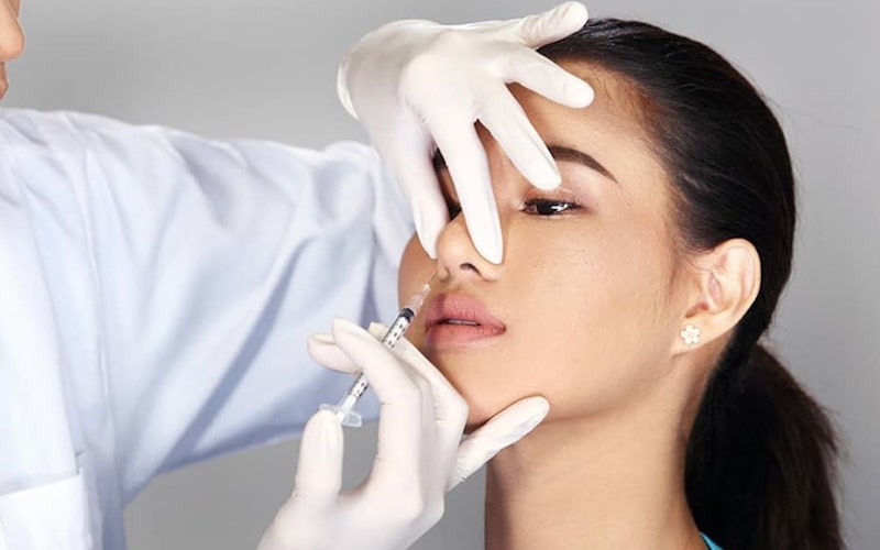  Tiêm filler mũi không cải thiện được tình trạng mũi lệch  