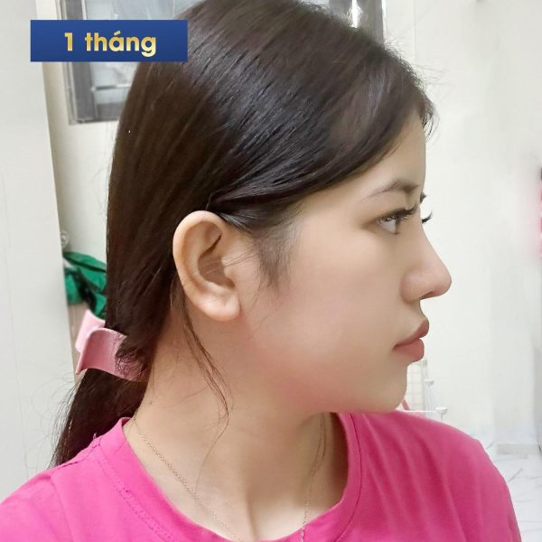 sự thay đổi tuyệt vời của chị Vân Anh