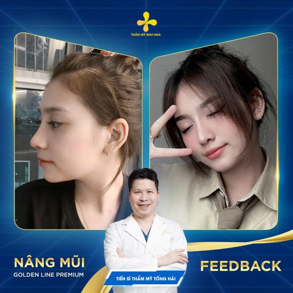 bóp mũi nhiều có to lên không