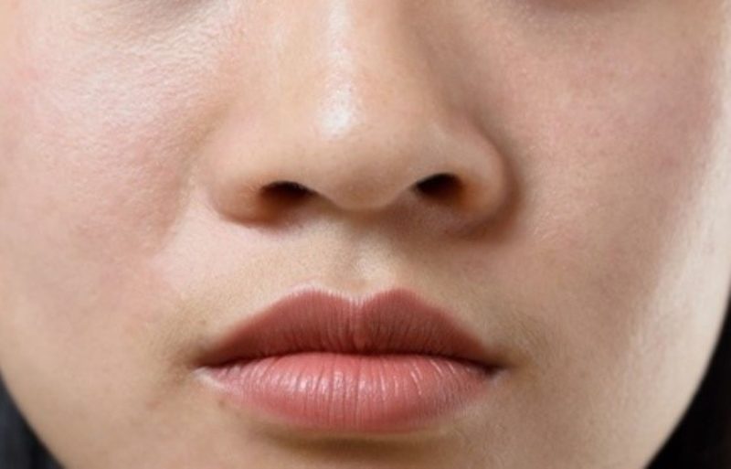 cười nhiều có làm mũi to không