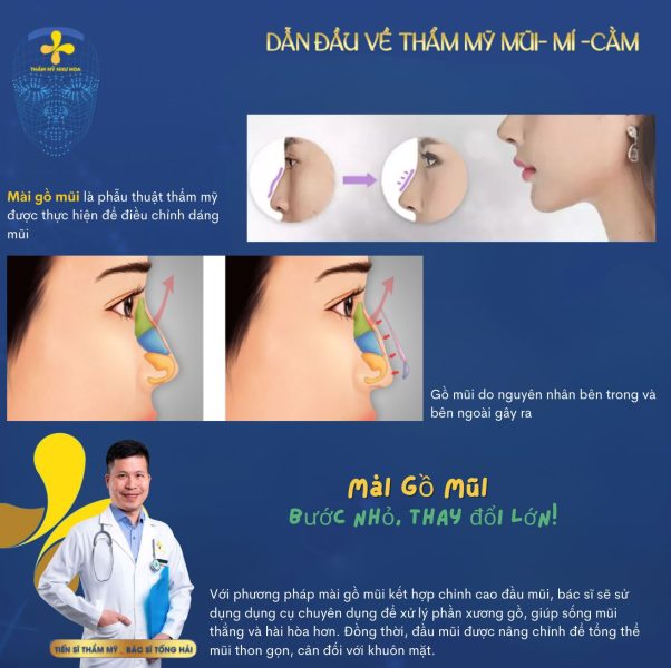 Tổng quan về mài gồ mũi