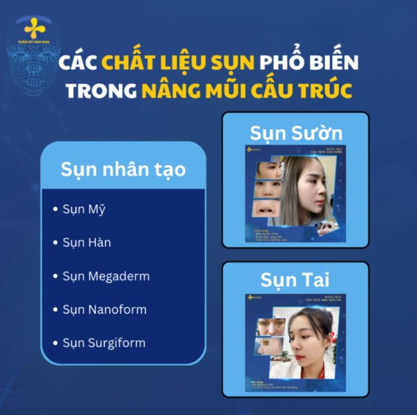 Các loại sụn trong nâng mũi cấu trúc