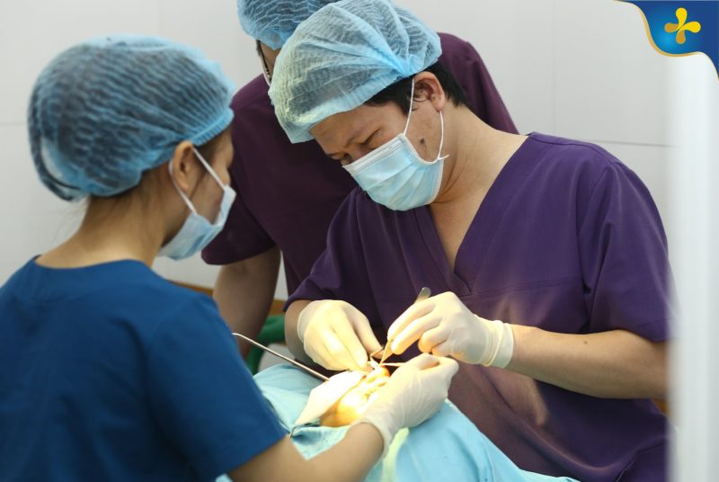 Nếu không có phương pháp phục hồi phù hợp, mũi sẽ có nguy cơ bị co rút sau khi rút sụn 