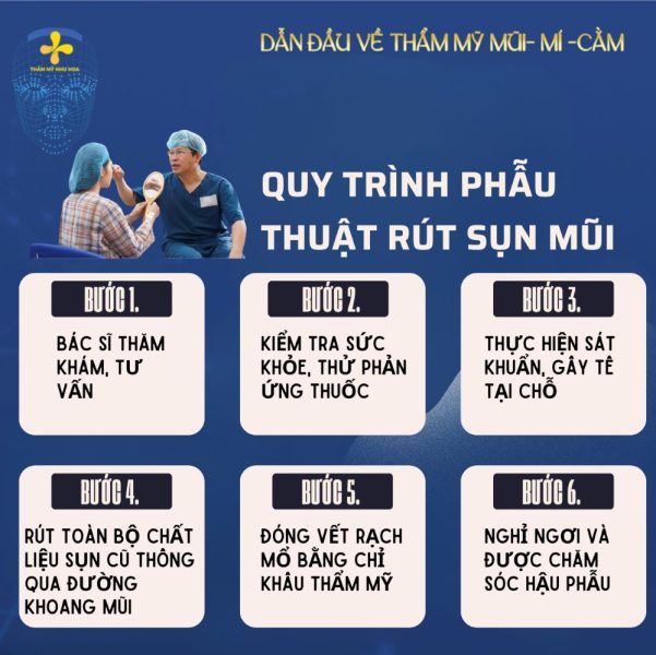 Quy trình rút sụn mũi