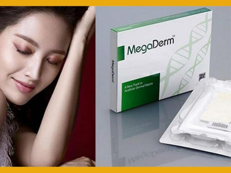 Chất liệu megaderm giúp giảm nguy cơ biến chứng thẩm mỹ
