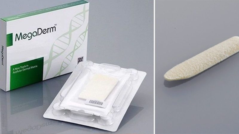 Chất liệu Megaderm được tin dùng trong ngành thẩm mỹ hiện nay