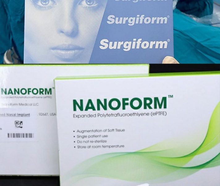Nên nâng mũi sụn nanoform hay surgiform