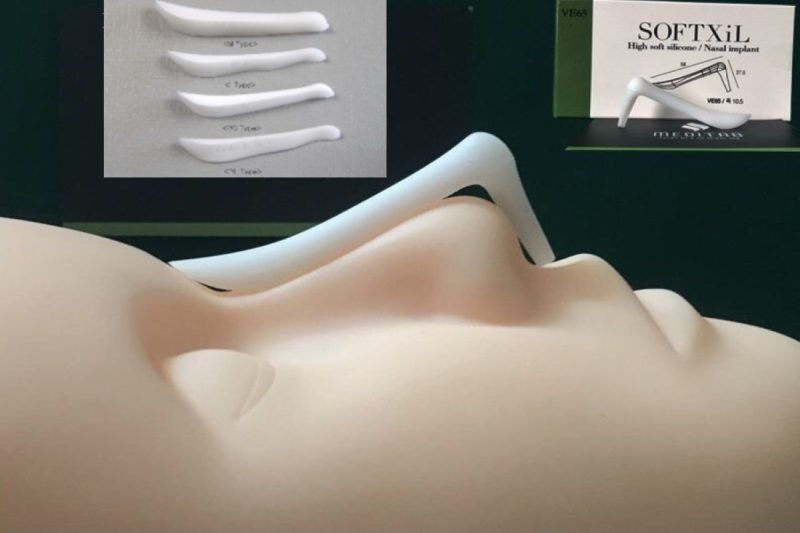 Nhược điểm của sụn Softxil 
