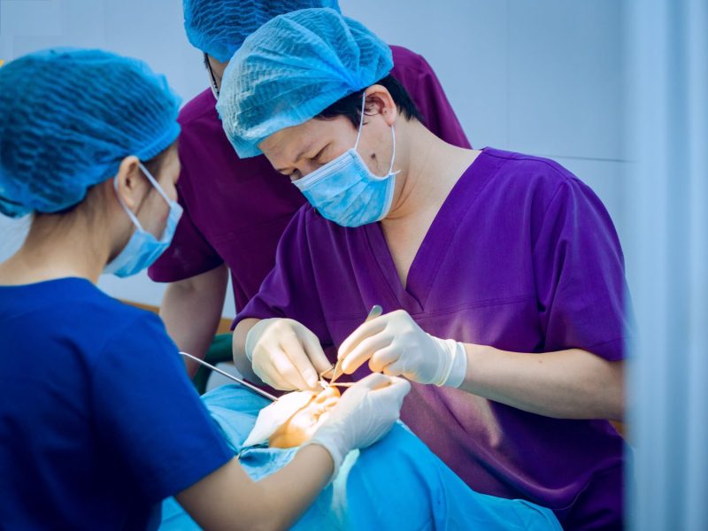 Lưu ý khi sử dụng sụn nâng mũi Softxil nâng mũi 
