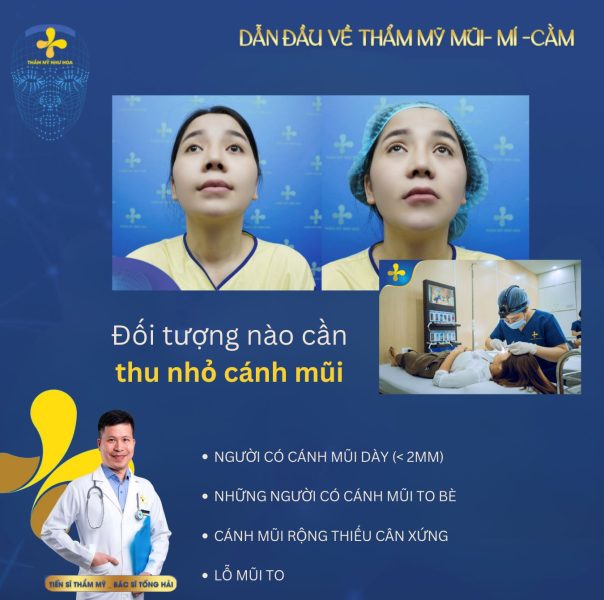 Đối tượng nào cần thu nhỏ cánh mũi