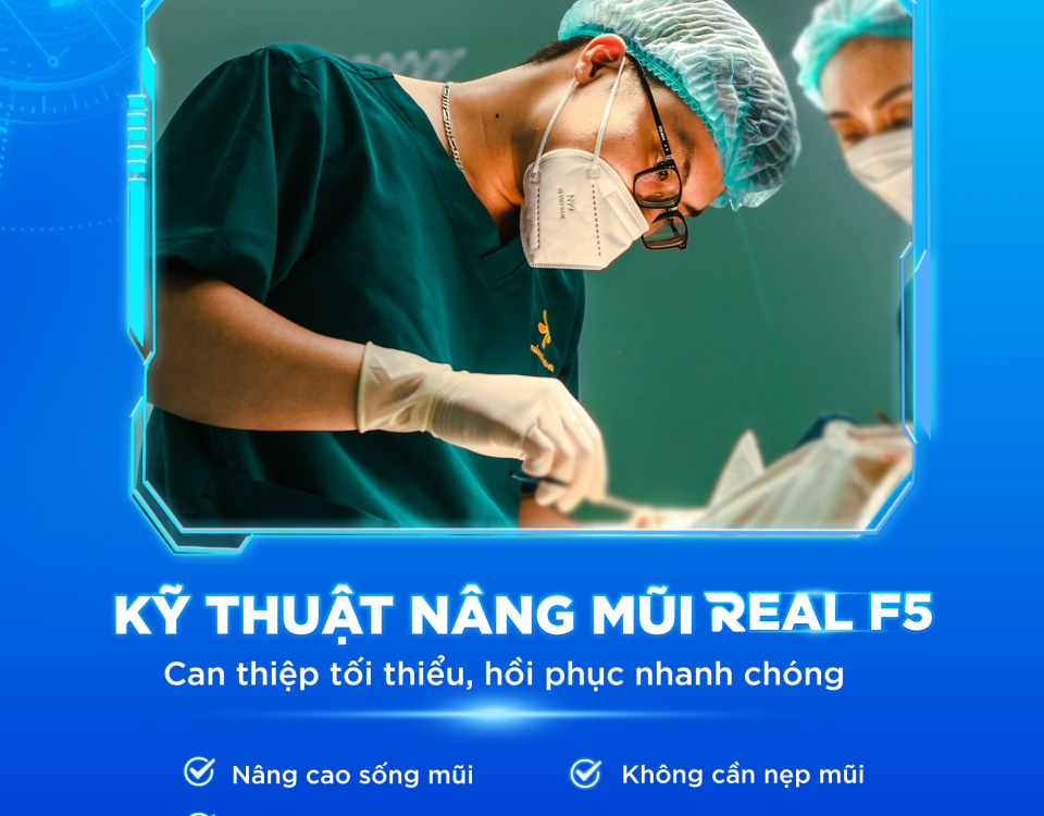 Ky thuat nang mui Real F5 da sua