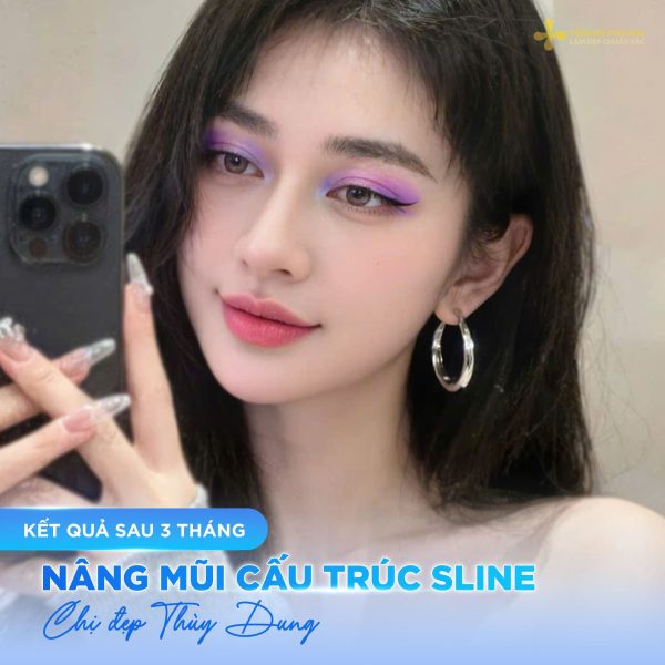 Nâng mũi được bao lâu? Bật mí cách giữ dáng mũi chuẩn cùng chuyên gia 7 3 thang 1