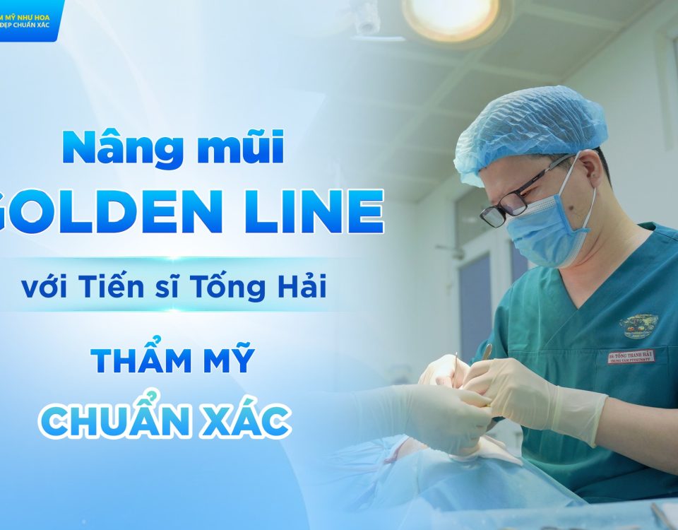 anh 4