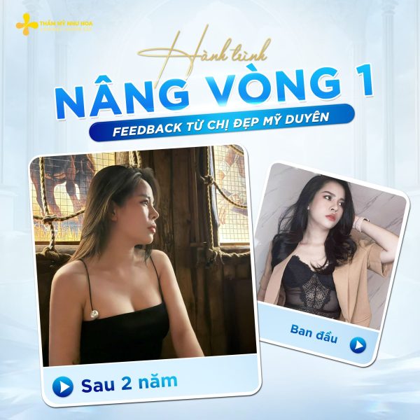 Quy trình hút mỡ bụng chuẩn xác cùng Tiến sĩ Tống Hải - Giải pháp an toàn cho vóc dáng thon gọn 7 my duyen 1