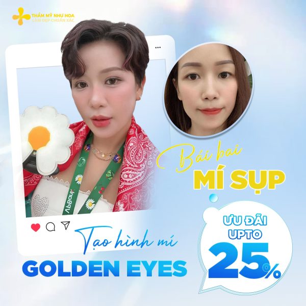 Chi tiết quy trình 14 bước chuẩn xác tạo hình mí Golden Eyes 5 aa 1