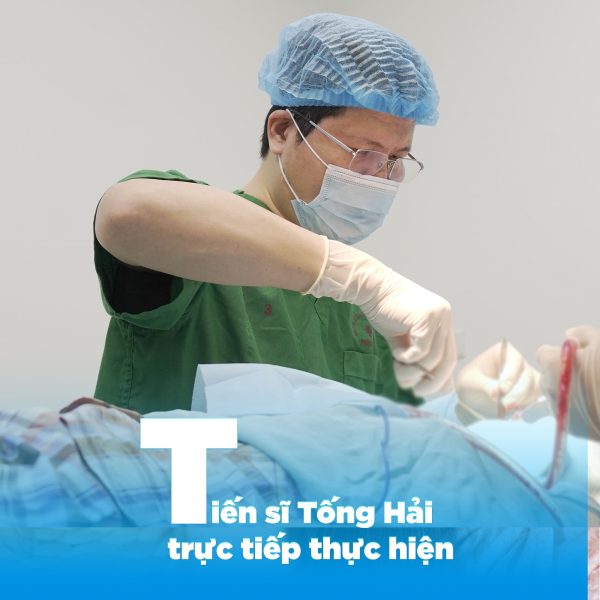 Nâng mũi được bao lâu? Bật mí cách giữ dáng mũi chuẩn cùng chuyên gia 9 lua chon bsi 1